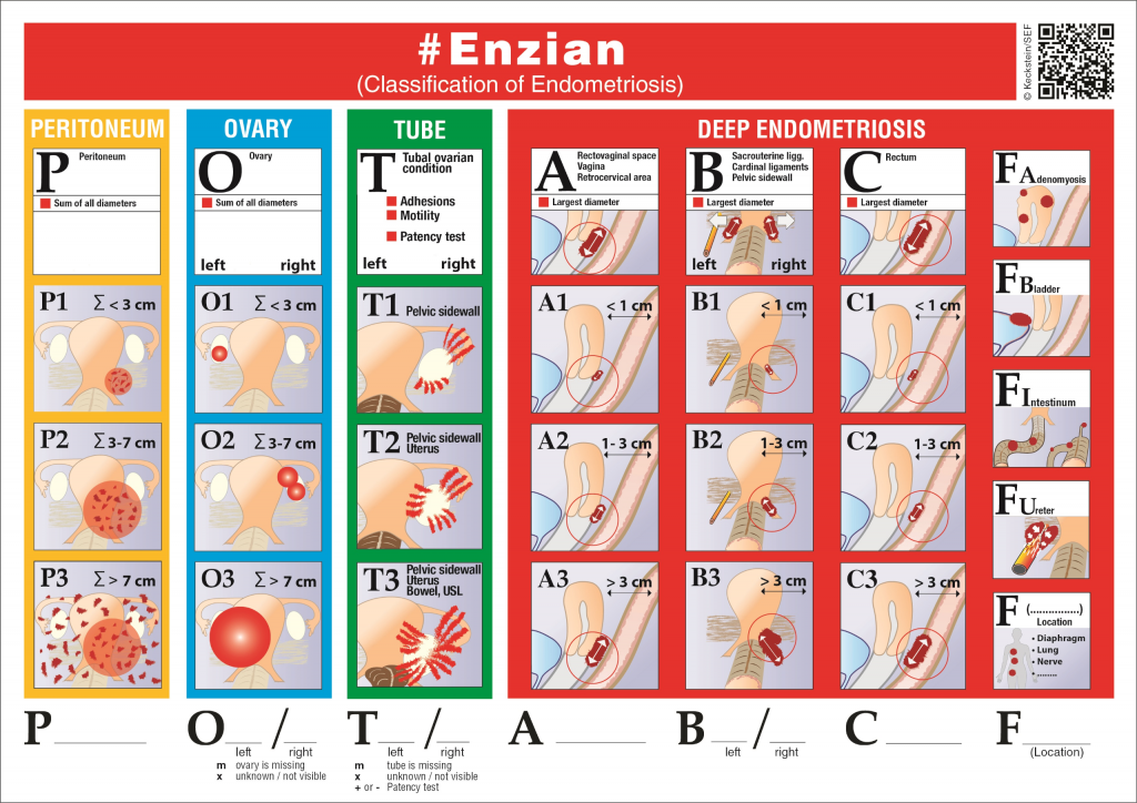 The new Enzian classification - Download